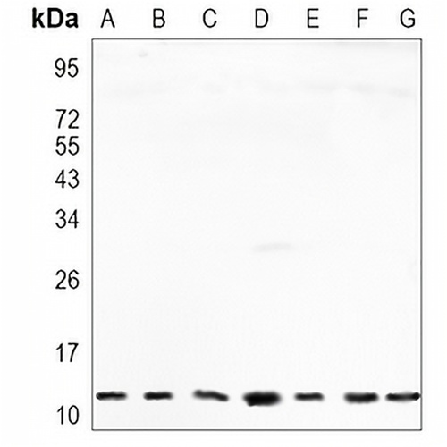 RPS20 Rabbit Monoclonal Antibody(C897)