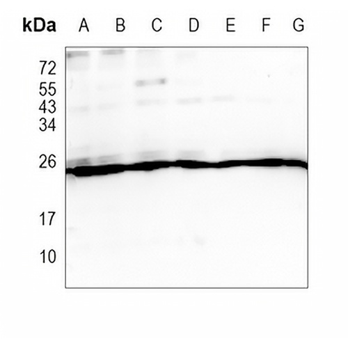 PSMA2 Rabbit Monoclonal Antibody(C898)