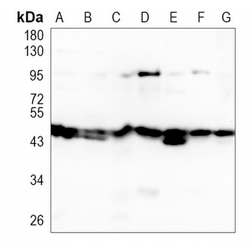 PSMC4 Rabbit Monoclonal Antibody(C900)