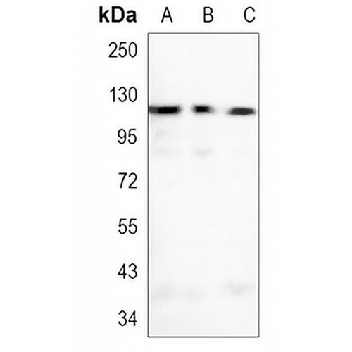 Focal Adhesion Kinase Rabbit Monoclonal Antibody(C901)