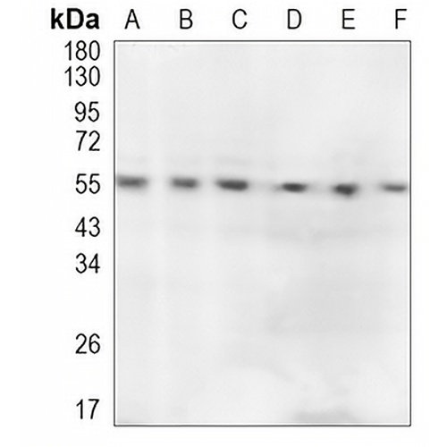 STAU1 Rabbit Monoclonal Antibody(C902)