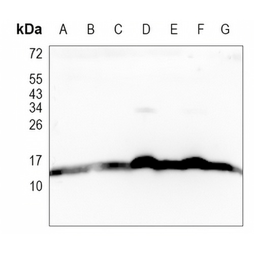 NDUFB4 Rabbit Monoclonal Antibody(C905)