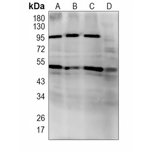 TP-1 Rabbit Monoclonal Antibody(C906)