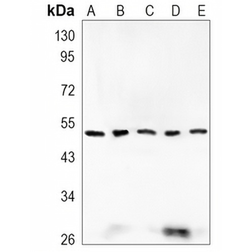 ILK Rabbit Monoclonal Antibody(C907)