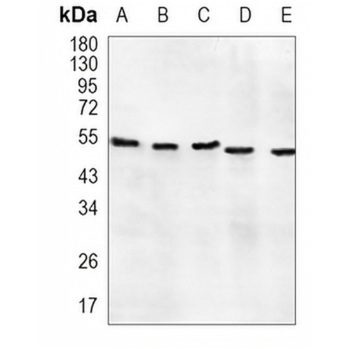 PTEN Rabbit Monoclonal Antibody(C908)