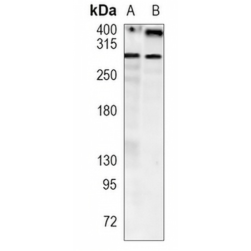 USP9X Rabbit Monoclonal Antibody(C910)
