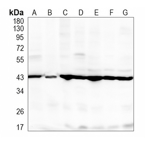 GOT2 Rabbit Monoclonal Antibody(C911)
