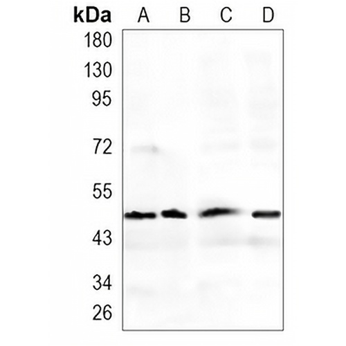 ERp5 Rabbit Monoclonal Antibody(C912)