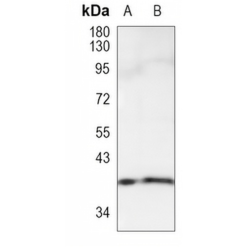 ATG3 Rabbit Monoclonal Antibody(C914)