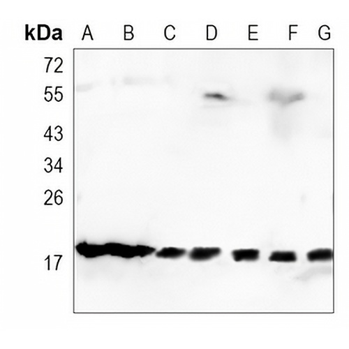UBC9 Rabbit Monoclonal Antibody(C915)