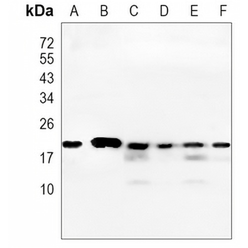 CDC42 Rabbit Monoclonal Antibody(C916)