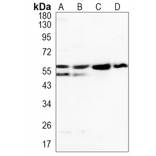 PDI Rabbit Monoclonal Antibody(C919)