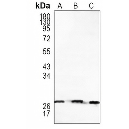 HSP27 (Phospho-S82) Rabbit Monoclonal Antibody(C920)