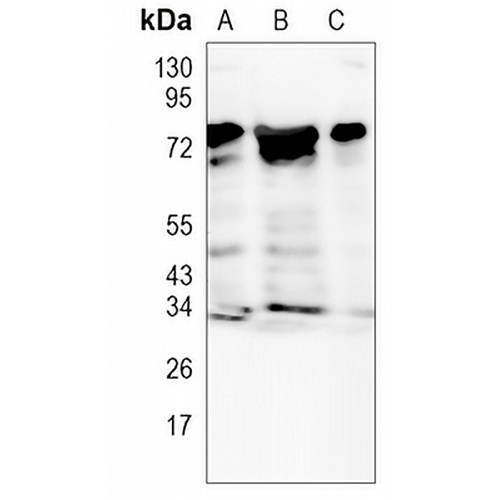 Metadherin Rabbit Monoclonal Antibody(C921)
