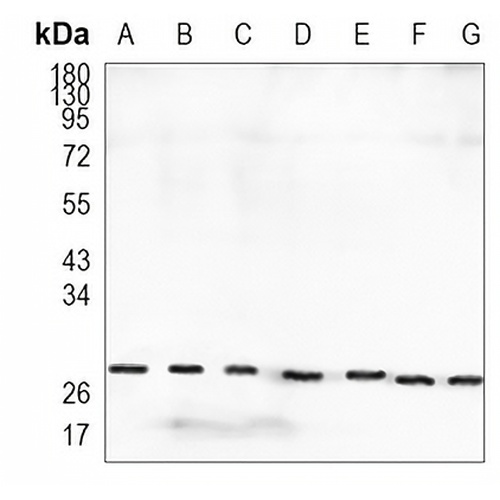 HSP27 Rabbit Monoclonal Antibody(C922)
