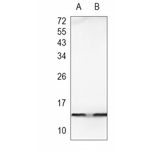 Histone H2A (Acetyl-K9) Rabbit Monoclonal Antibody(C924)