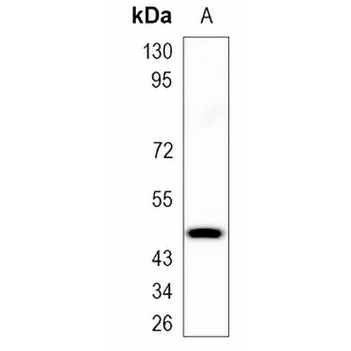 FOSB Rabbit Monoclonal Antibody(C925)