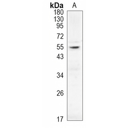AKT (Phospho-T450) Rabbit Monoclonal Antibody(C926)