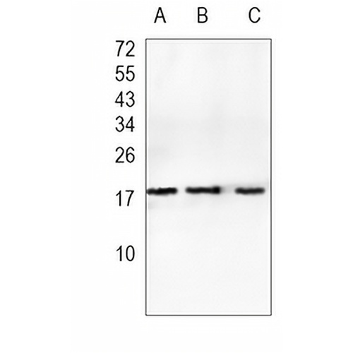 MYL9 Rabbit Monoclonal Antibody(C927)