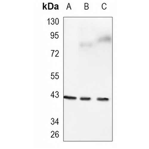 CCR9 Rabbit Monoclonal Antibody(C928)