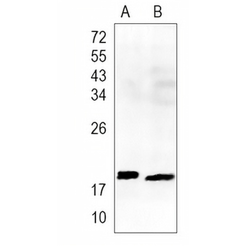 Troponin C Rabbit Monoclonal Antibody(C929)