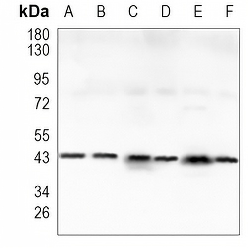 GAP43 Rabbit Monoclonal Antibody(C930)