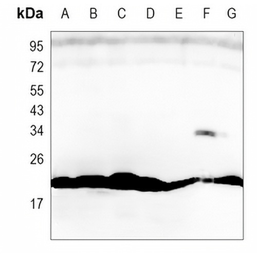 IL-1RA Rabbit Monoclonal Antibody(C931)