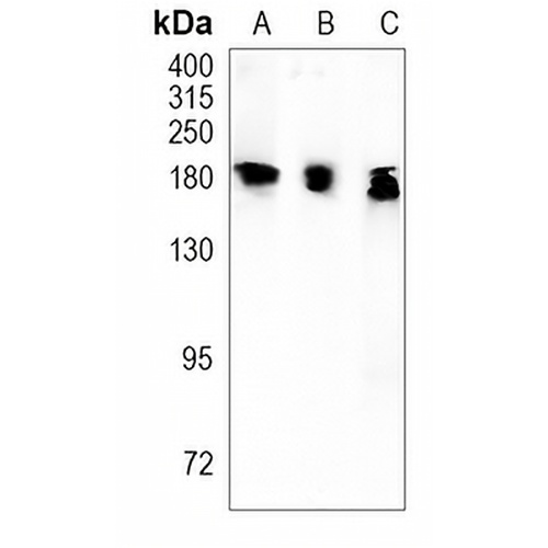ATP2B1 Rabbit Monoclonal Antibody(C933)
