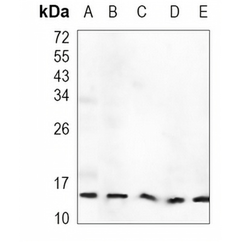 H-FABP Rabbit Monoclonal Antibody(C934)
