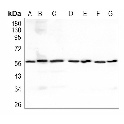 SOX10 Rabbit Monoclonal Antibody(C937)