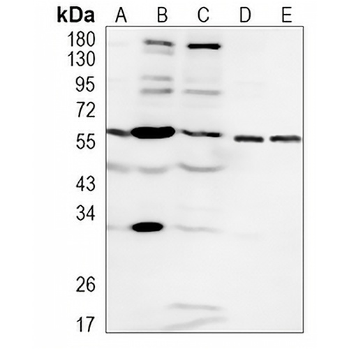 Estrogen Receptor alpha Rabbit Monoclonal Antibody(C938)