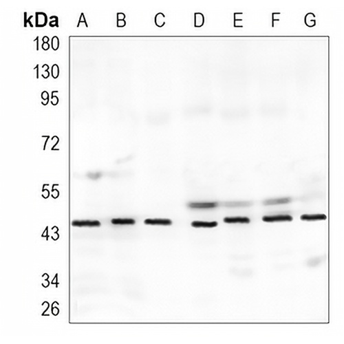 uPA Rabbit Monoclonal Antibody(C939)