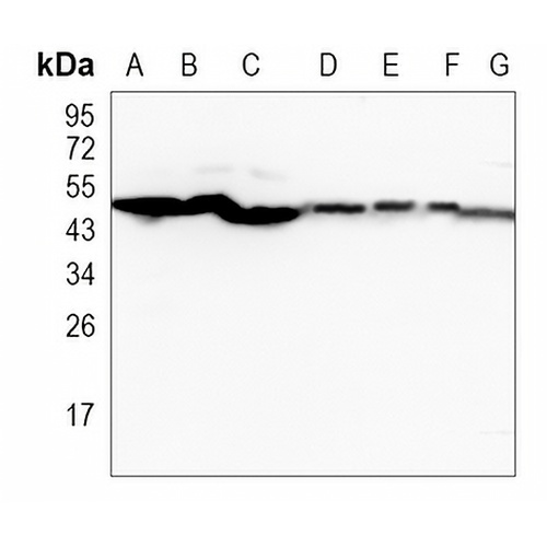 LOX Rabbit Monoclonal Antibody(C941)