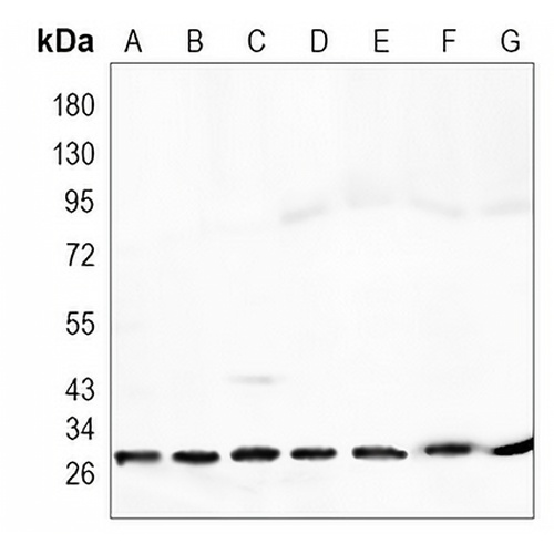 pro-NGF beta Rabbit Monoclonal Antibody(C942)
