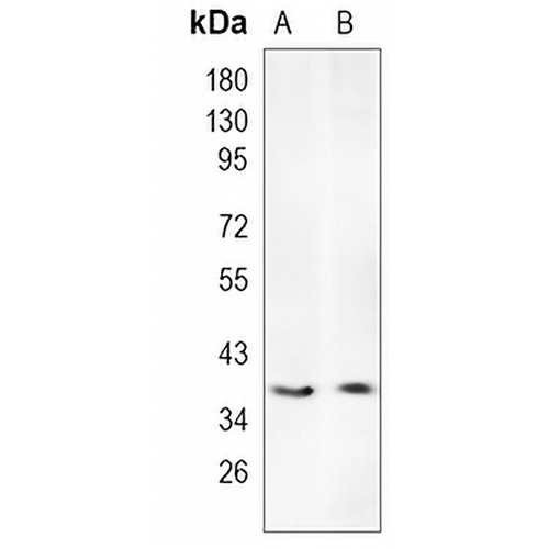 Loricrin Rabbit Monoclonal Antibody(C945)