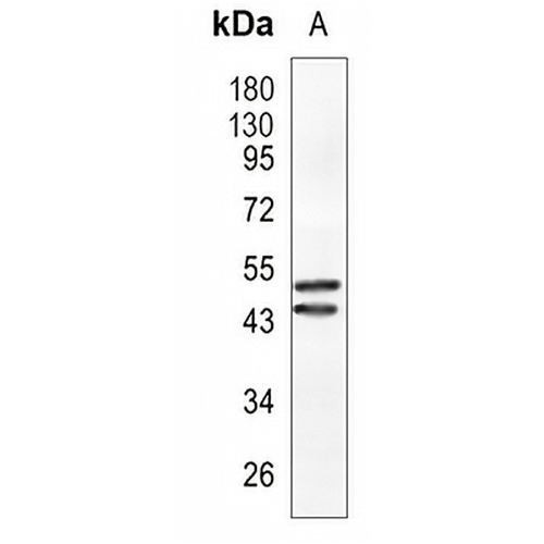 CLP1 Rabbit Monoclonal Antibody(C946)
