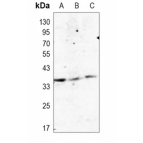C3orf38 Rabbit Monoclonal Antibody(C947)