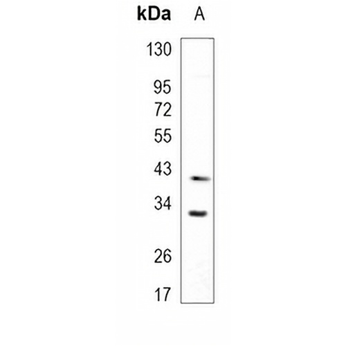 HO-1 Rabbit Monoclonal Antibody(C948)