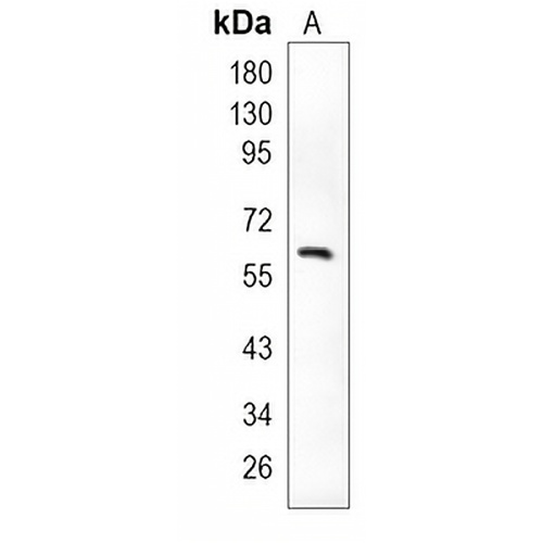 Paxillin Rabbit Monoclonal Antibody(C949)
