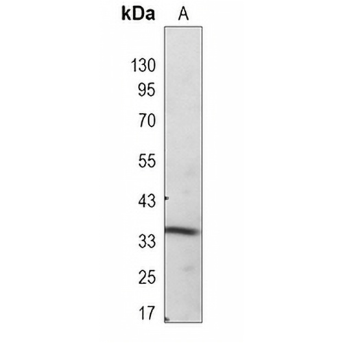 SRR Rabbit Monoclonal Antibody(C955)
