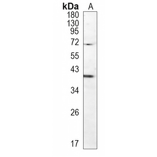 FOXF1 Rabbit Monoclonal Antibody(C957)