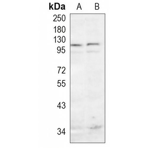 Catenin delta 1 Rabbit Monoclonal Antibody(C958)