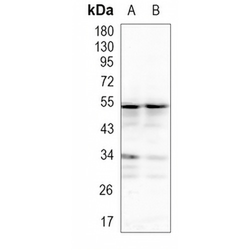 TEAD1/2/3/4 Rabbit Monoclonal Antibody(C960)