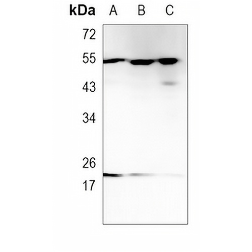 Vimentin Rabbit Monoclonal Antibody(C961)