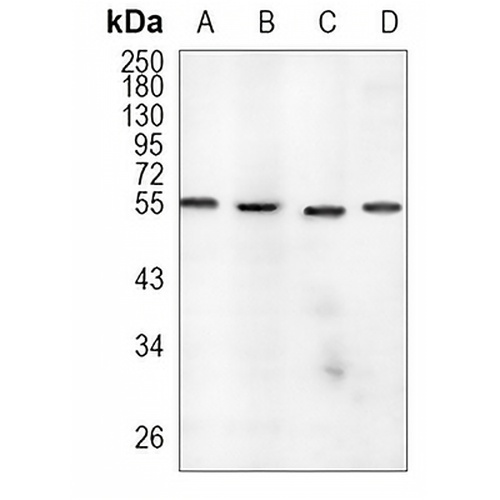 EOGT Rabbit Monoclonal Antibody(C963)