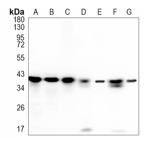 STOML2 Rabbit Monoclonal Antibody(C964)