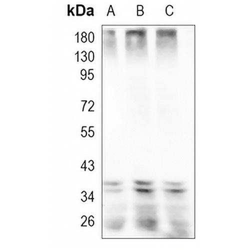 MKK3/6 Rabbit Monoclonal Antibody(C968)