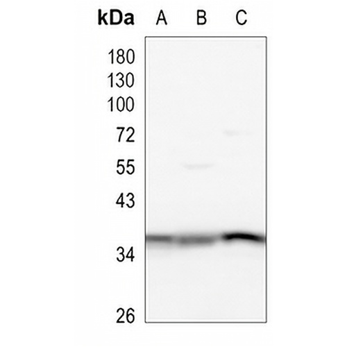PP2A-alpha/beta Rabbit Monoclonal Antibody(C969)