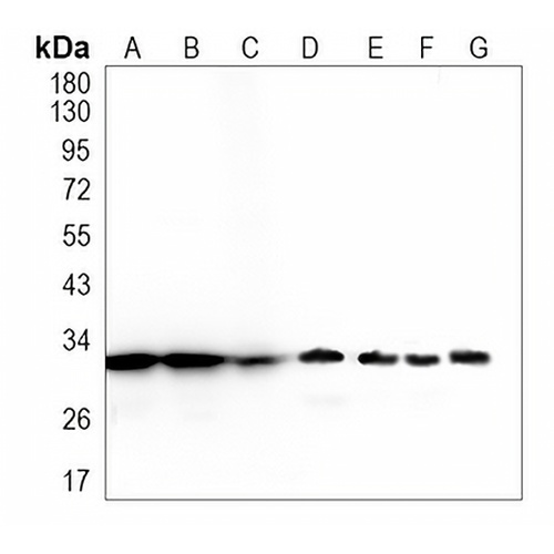 EF-Ts Rabbit Monoclonal Antibody(C970)