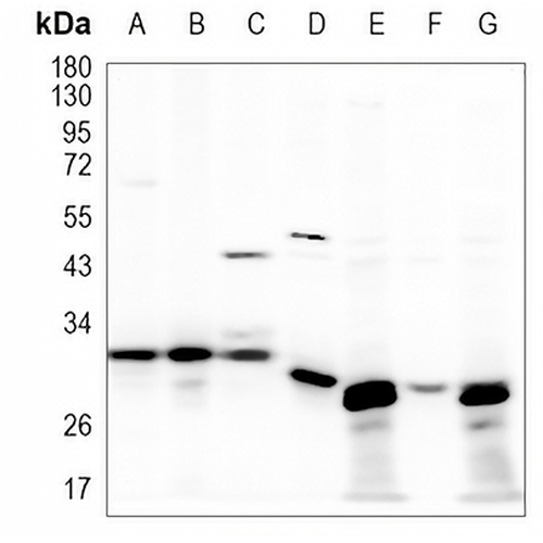 TPMT Rabbit Monoclonal Antibody(C971)